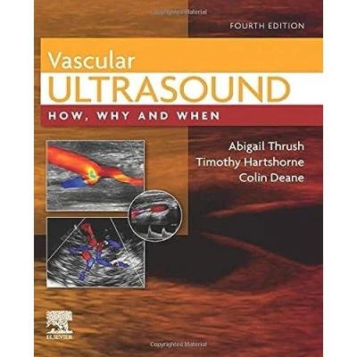 Afbeelding van Vascular Ultrasound: How, Why and When