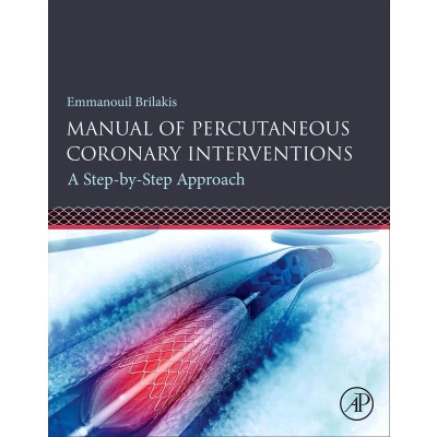 Afbeelding van Manual of Percutaneous Coronary Interventions: A Step by Approach