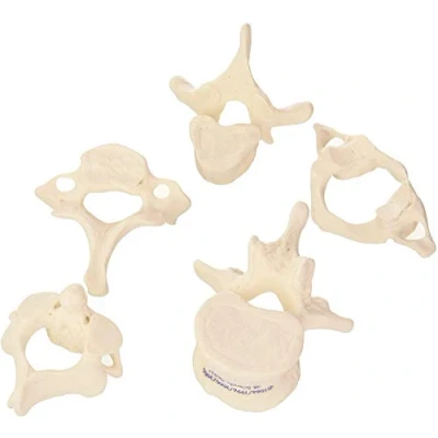 Afbeelding van 3B Scientific 5 wervels, delig + gratis anatomiesoftware slimme anatomie A75/1