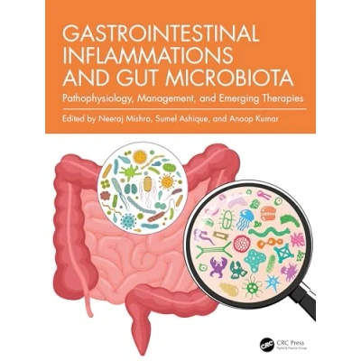 Afbeelding van Gastrointestinal Inflammations and Gut Microbiota