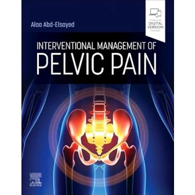 Afbeelding van Interventional Management of Pelvic Pain