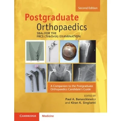 Afbeelding van SBAs for the FRCS (Tr&amp;Orth) Examination: A Companion to Postgraduate Orthopaedics Candidate&#039;s Guide