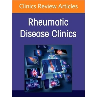 Afbeelding van The Clinics: Internal MedicineVolume 50 2 Rheumatic immune related adverse events, An Issue of Disease Clinics North America