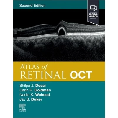 Afbeelding van Atlas of Retinal OCT: Optical Coherence Tomography