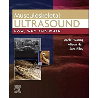 Afbeelding van Musculoskeletal Ultrasound: How, Why and When