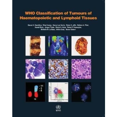 Afbeelding van WHO Classification of Tumours Haematopoietic and Lymphoid Tissues: Vol. 2
