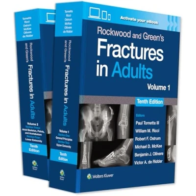 Afbeelding van Rockwood and Green&#039;s Fractures in Adults: Print + eBook with Multimedia
