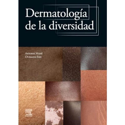 Afbeelding van Dermatología de la diversidad