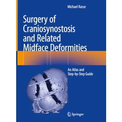 Afbeelding van Surgery of Craniosynostosis and Related Midface Deformities: An Atlas Step by Guide