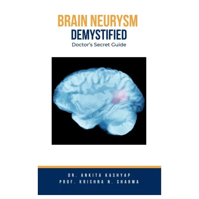 Afbeelding van Brain Aneurysm Demystified: Doctor&#039;s Secret Guide