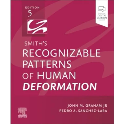 Afbeelding van Smith&#039;s Recognizable Patterns of Human Deformation