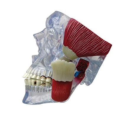 Afbeelding van 3B Het TMJ model