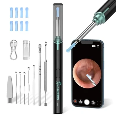 Afbeelding van VITCOCO Otoscoop met oorsmeerverwijderaar, 1920P Wifi oorreiniger, IP67 waterdicht otoscoopooroor, 360 groothoekotoscoopcamera 6 LED&#039;s voor volwassenen, kinderen en huisdieren