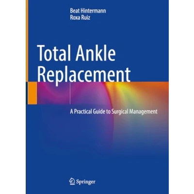 Afbeelding van Total Ankle Replacement: A Practical Guide to Surgical Management