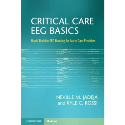 Afbeelding van Critical Care EEG Basics: Rapid Bedside Reading for Acute Providers
