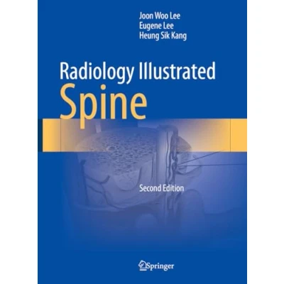 Afbeelding van Radiology Illustrated: Spine