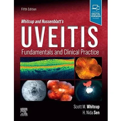 Afbeelding van Whitcup and Nussenblatt&#039;s Uveitis: Fundamentals Clinical Practice