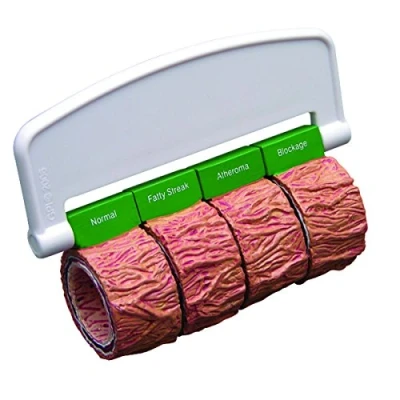 Afbeelding van 3B Slagadersecties (4) (extra groot) met handvat