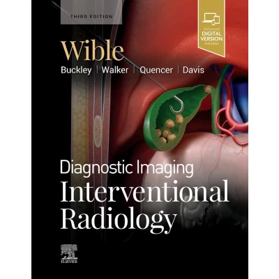 Afbeelding van Diagnostic Imaging: Interventional Radiology