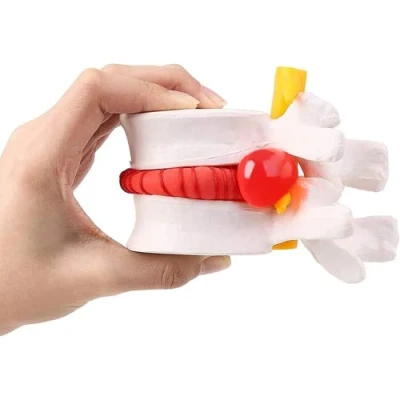Afbeelding van LSOAARRT Human Lumbale Disc Herniation Demonstratie Model van Vertebrale Rug