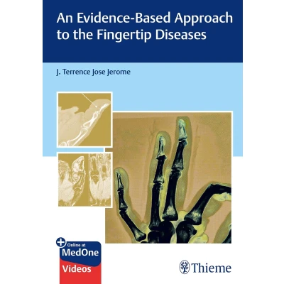 Afbeelding van An Evidence Based Approach to the Fingertip Diseases