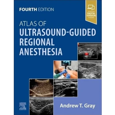Afbeelding van Atlas of Ultrasound Guided Regional Anesthesia