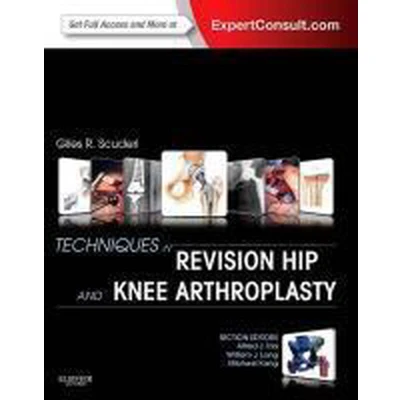 Afbeelding van Techniques In Revision Hip &amp; Knee Arthro