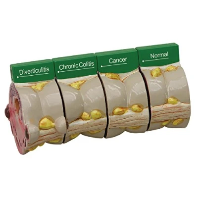 Afbeelding van GPI Anatomicals 3341 Dickdarm 4 schijfmodel