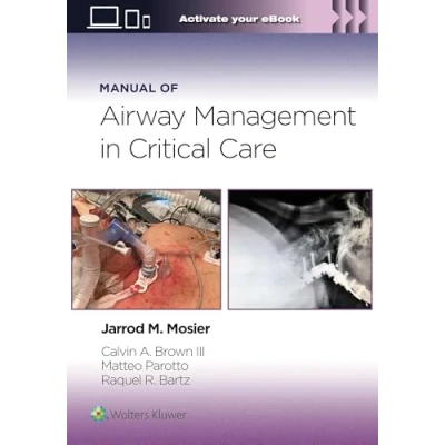 Afbeelding van Manual of Airway Management in Critical Care: Print + eBook with Multimedia
