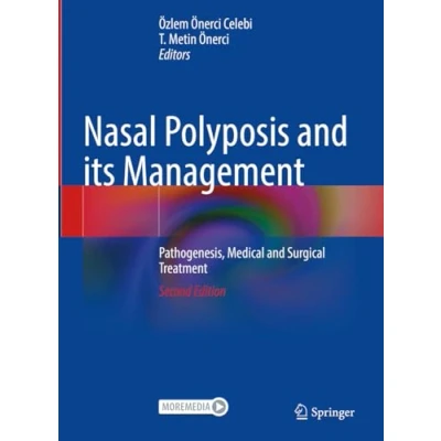 Afbeelding van Nasal Polyposis and its Management: Pathogenesis, Medical Surgical Treatment