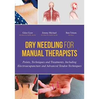 Afbeelding van Dry Needling for Manual Therapists: Points, Techniques and Treatments, Including Electroacupuncture Advanced Tendon