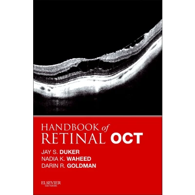 Afbeelding van Handbook of Retinal OCT: Optical Coherence Tomography