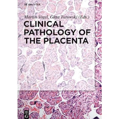Afbeelding van Clinical Pathology of the Placenta