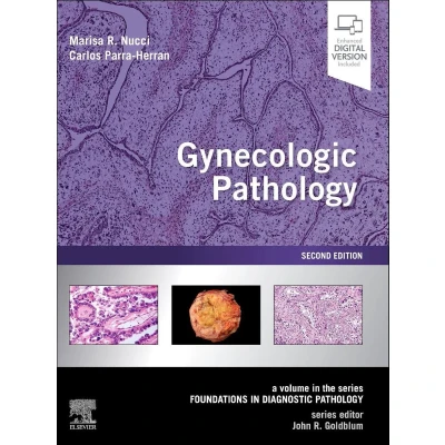 Afbeelding van Gynecologic Pathology: A Volume in Foundations Diagnostic Pathology Series