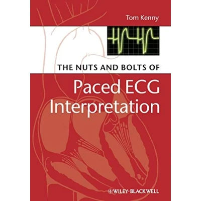 Afbeelding van The Nuts and Bolts of Interpreting Paced ECGs EGMs