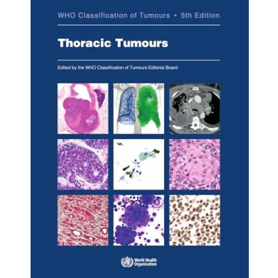 Afbeelding van Thoracic Tumours: Who Classification of 5