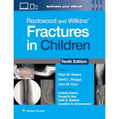 Afbeelding van Rockwood And Wilkins&#039; Fractures in Children