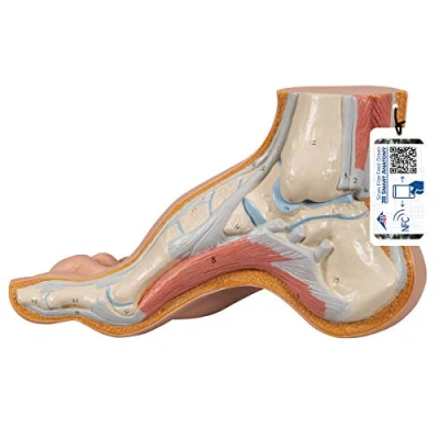 Afbeelding van 3B Scientific Menselijke anatomie model holle voet (Pes cavus) + gratis anatomiesoftware Smart Anatomy, M32