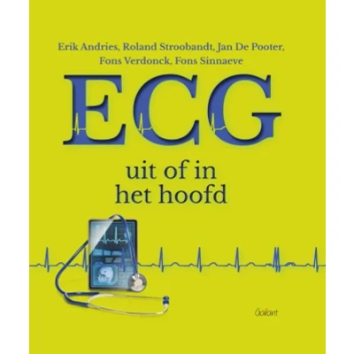 Afbeelding van ECG