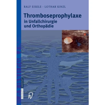 Afbeelding van Thromboseprophylaxe in Unfallchirurgie und Orthopaedie