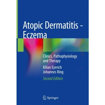 Afbeelding van Atopic Dermatitis Eczema: Clinics, Pathophysiology and Therapy