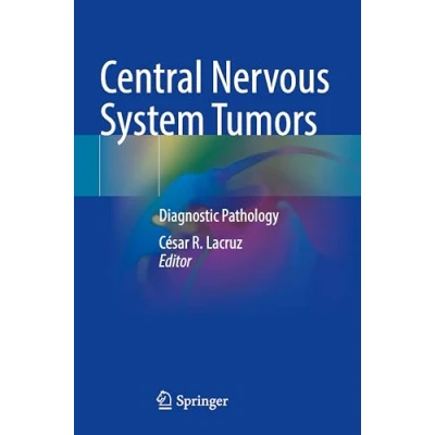 Afbeelding van Central Nervous System Tumors