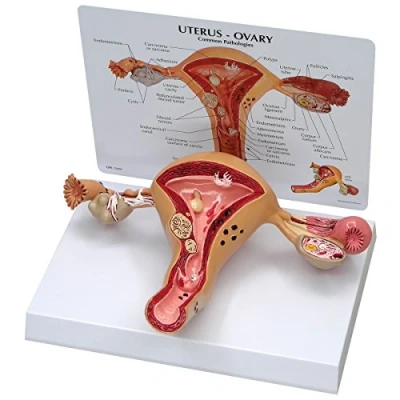Afbeelding van GPI Anatomicals W33352 Uterus model