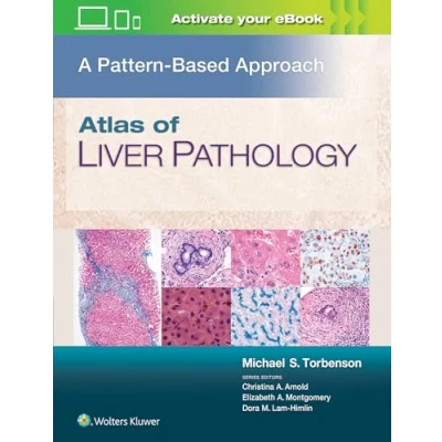 Afbeelding van Atlas of Liver Pathology: A Pattern Based Approach