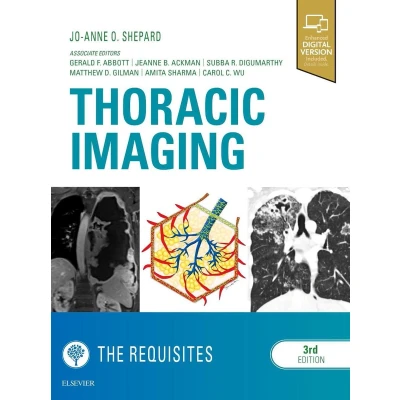 Afbeelding van Thoracic Imaging the Requisites