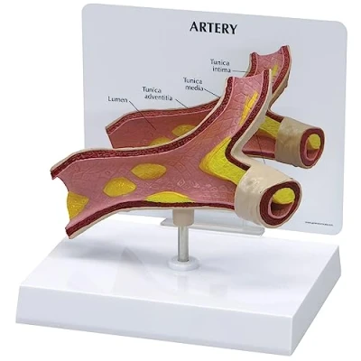 Afbeelding van 3B Het Model van de slagader