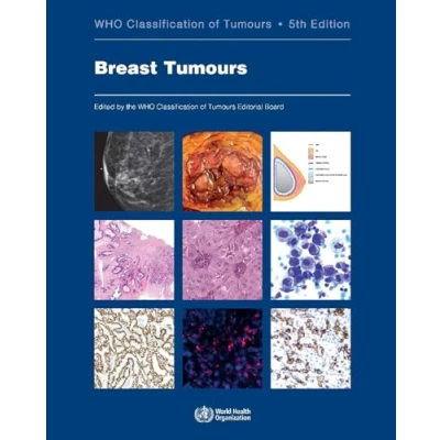Afbeelding van WHO Classification of Breast Tumours: Tumours, Volume 2