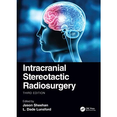 Afbeelding van Intracranial Stereotactic Radiosurgery