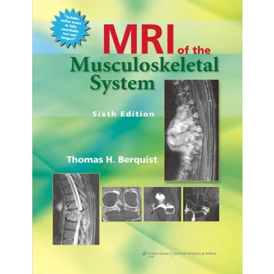 Afbeelding van Mri Of The Musculoskeletal System
