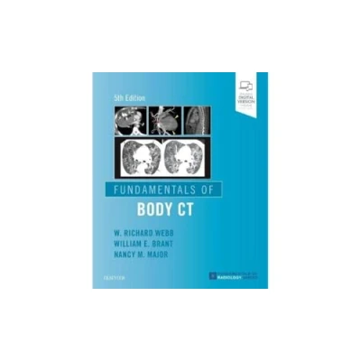 Afbeelding van Fundamentals of Body CT